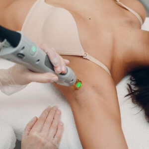 A woman undergoing a laser hair treatment on her arm, showcasing a clinical setting and focused care.